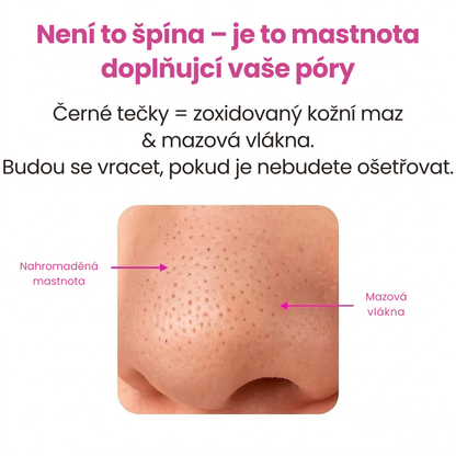 Dermify PurePore: Vakuový čistič pórů