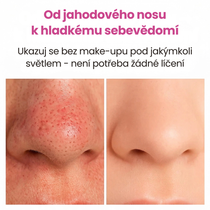 Dermify PurePore: Vakuový čistič pórů